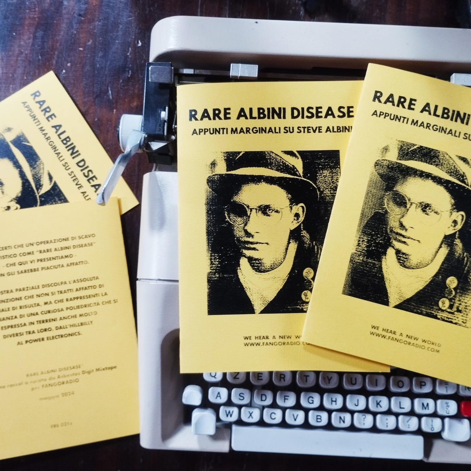 Rare Albini Disease